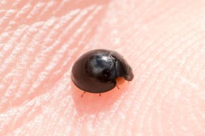 Parexochomus nigromaculatus